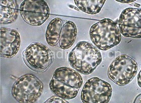 球形棕囊藻(GY-H37 Phaeocystis globsa)