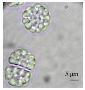 圖12. Aurantiochytrium limacinum（不知道中文叫什么，可以看到細(xì)胞里一個個油滴，by Abad &Turon, 2015）